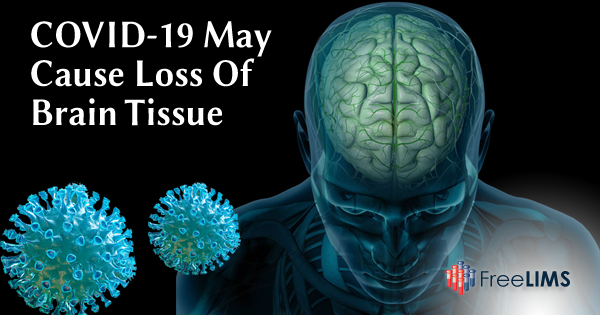 COVID-19 May Cause Loss of Brain Tissue